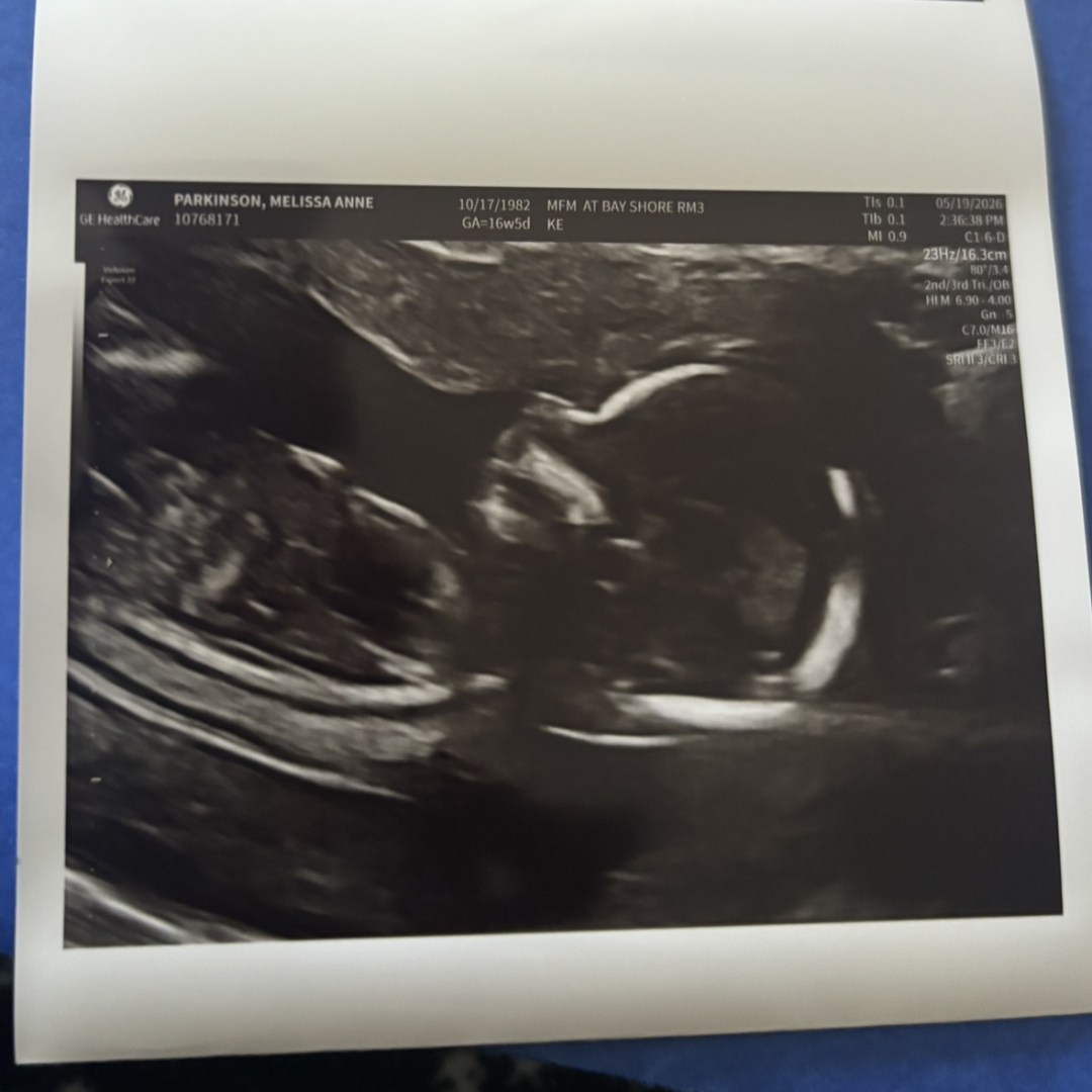 Photo shared by Melissa for their Babylist baby registry.