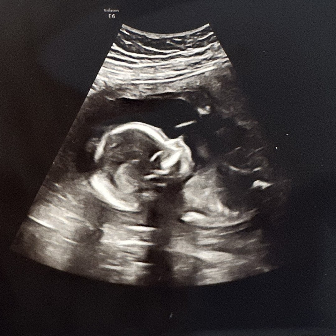 Photo shared by Miranda for their Babylist baby registry.
