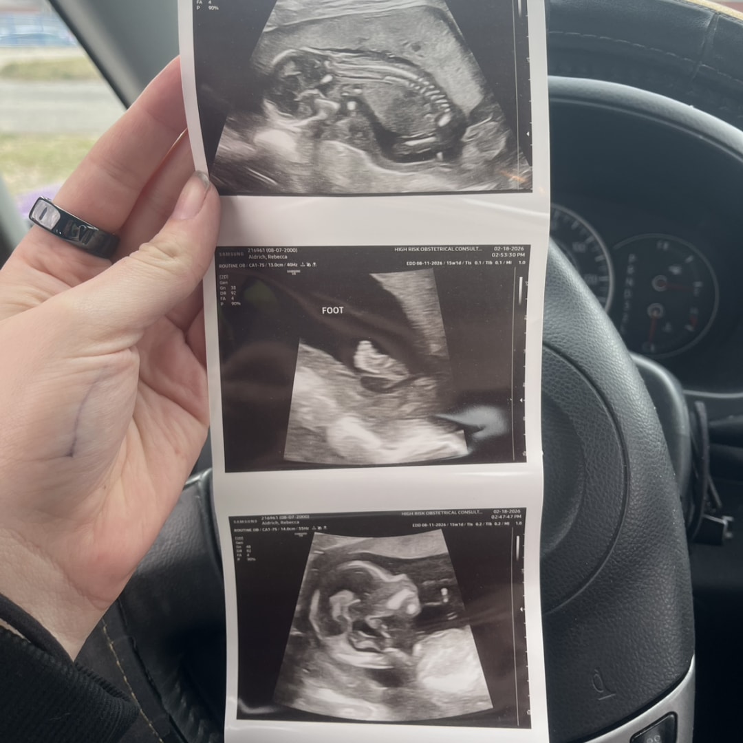 Photo shared by Rebecca for their Babylist baby registry.