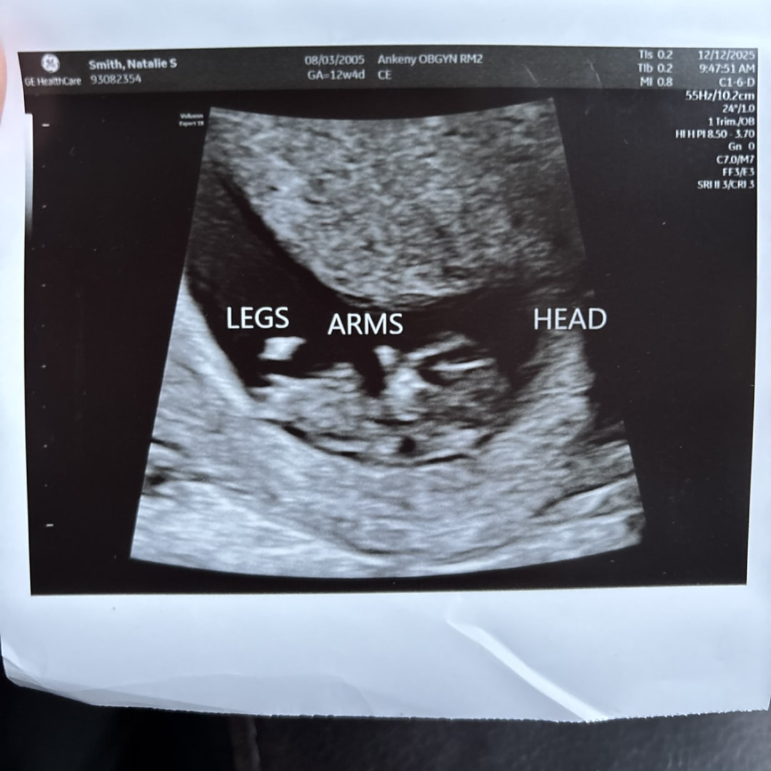 Photo shared by Natalie for their Babylist baby registry.