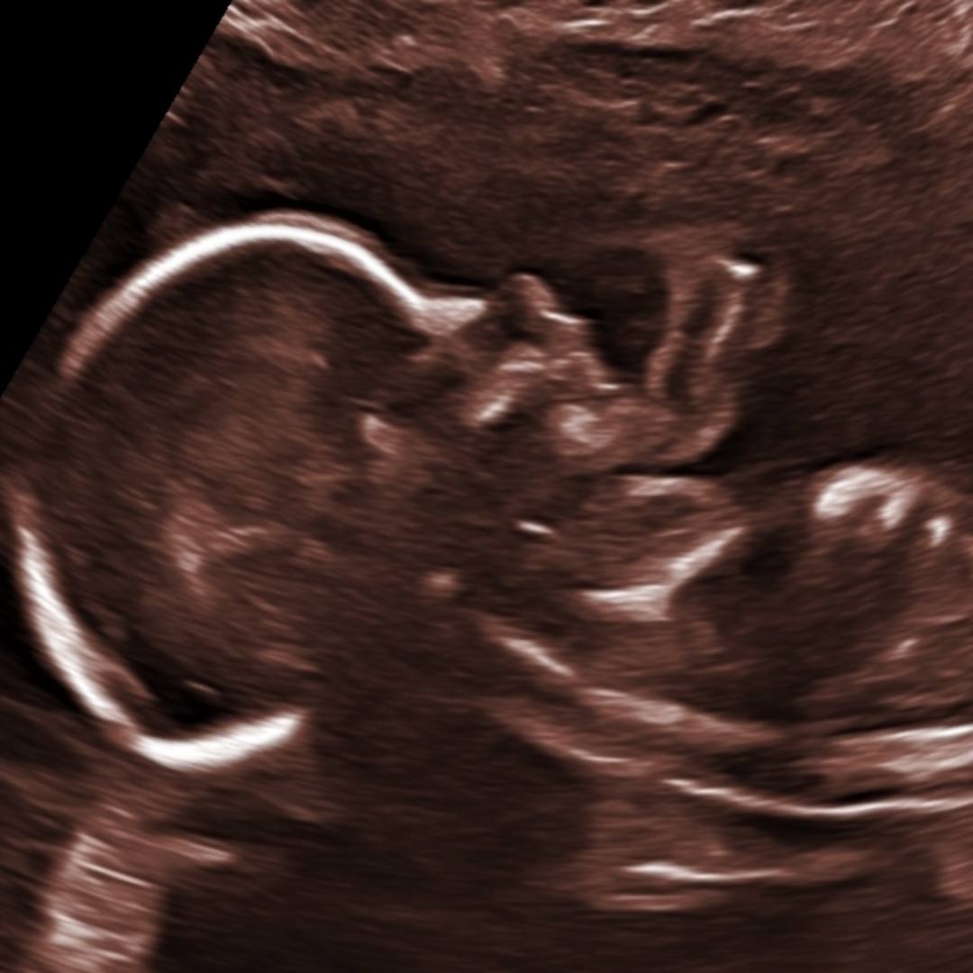 Photo shared by Manzanita for their Babylist baby registry.