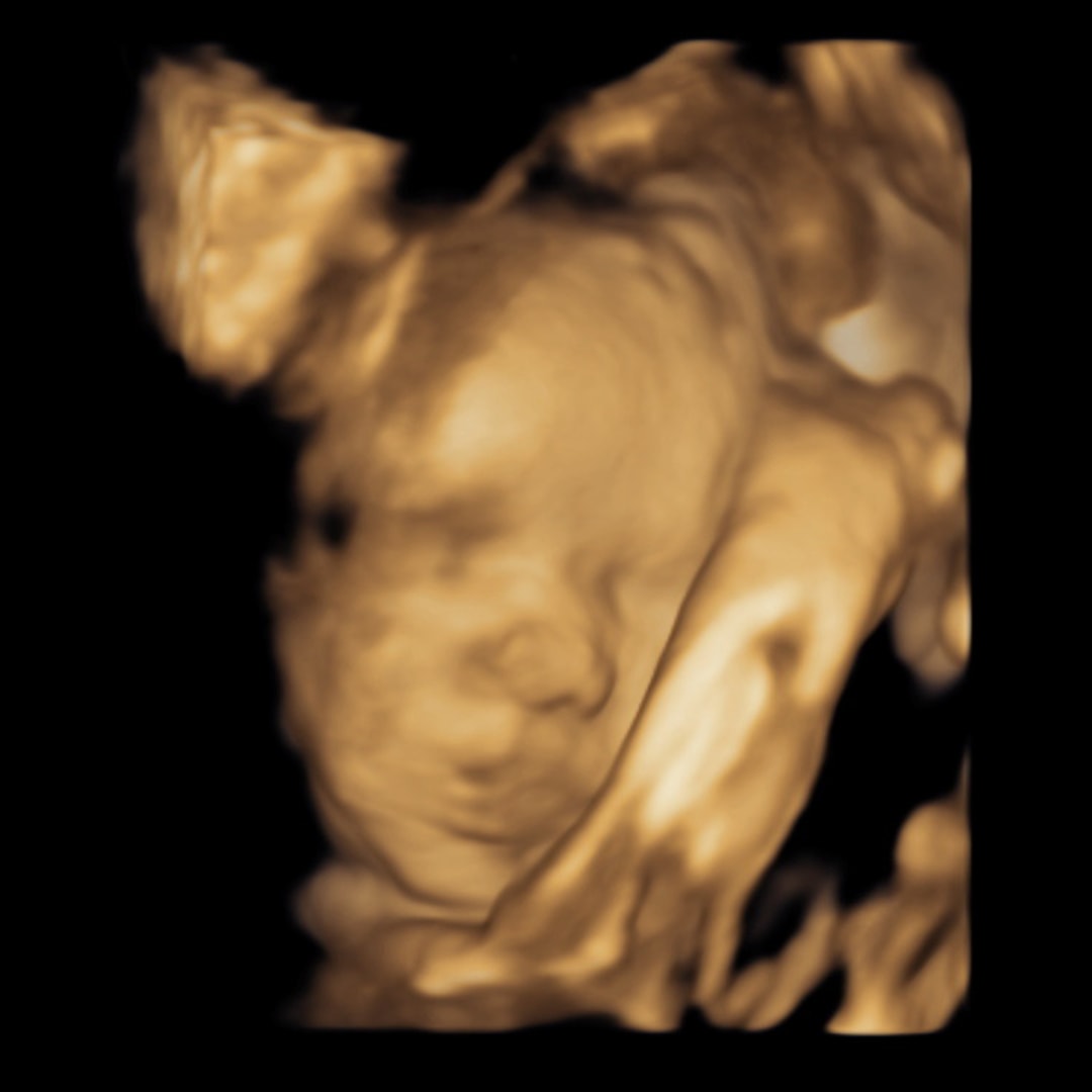 Photo shared by Alize for their Babylist baby registry.