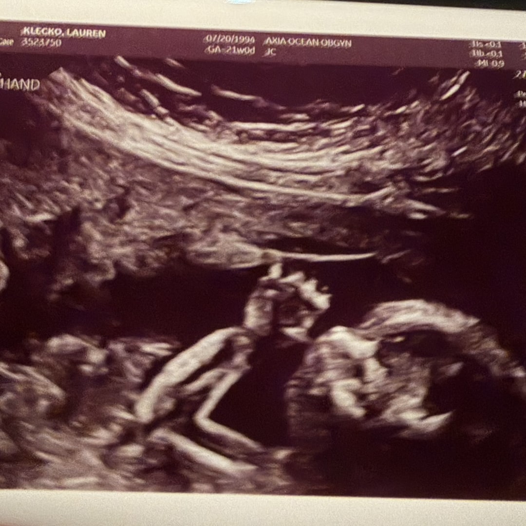 Photo shared by Lauren for their Babylist baby registry.