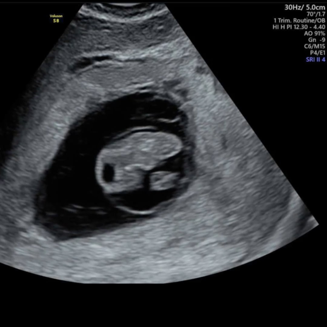 Photo shared by Jaclyn for their Babylist baby registry.