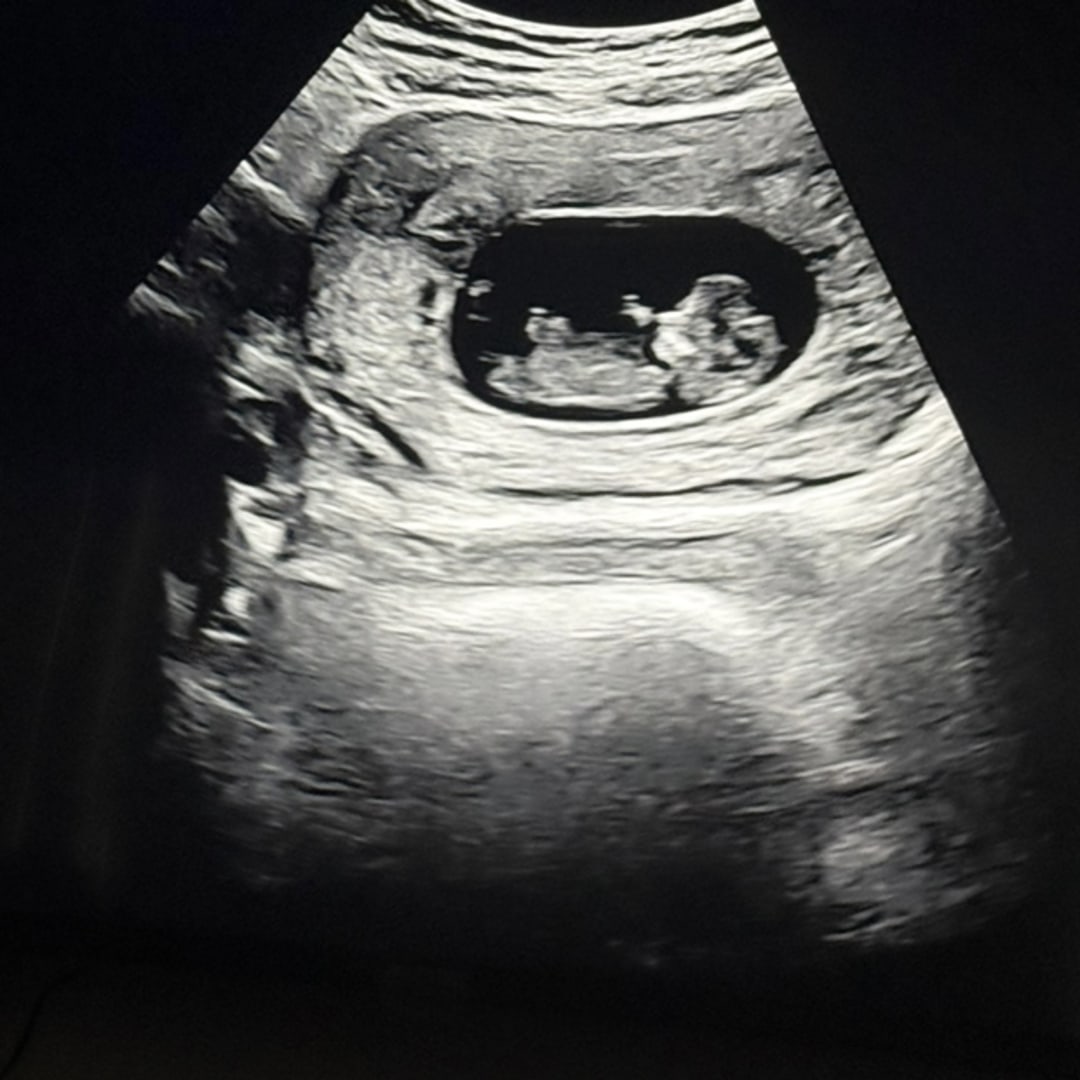 Photo shared by Raven for their Babylist baby registry.