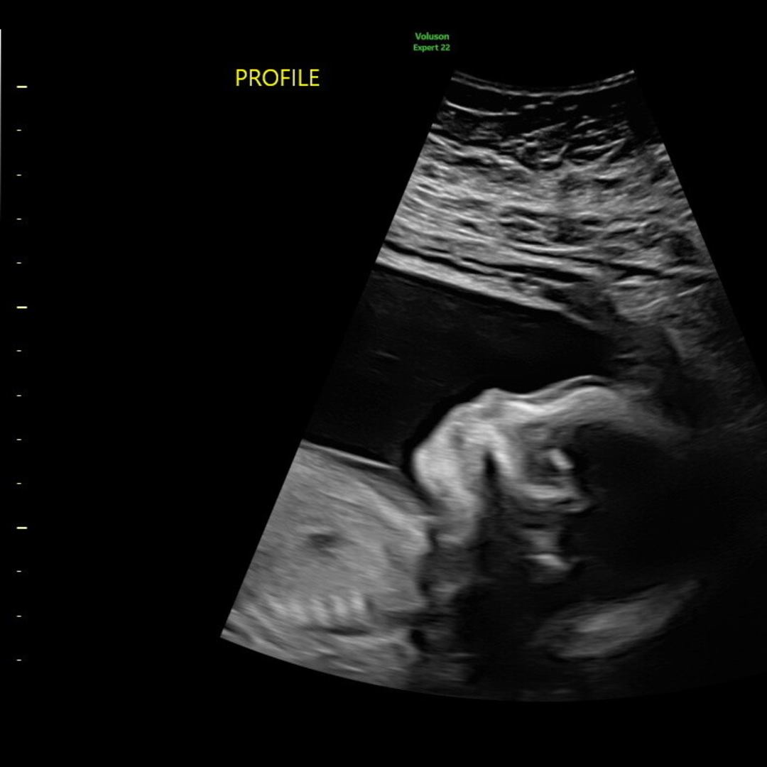 Photo shared by Sol for their Babylist baby registry.