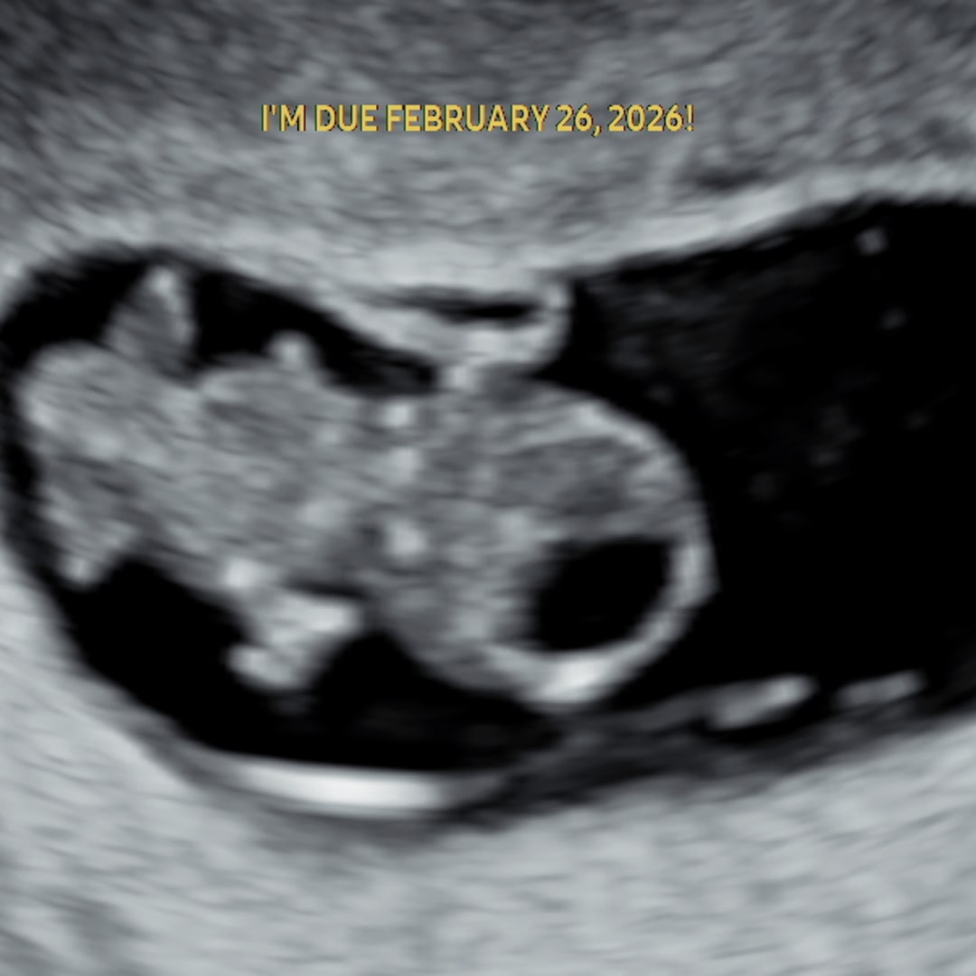 Photo shared by Alexandria for their Babylist baby registry.
