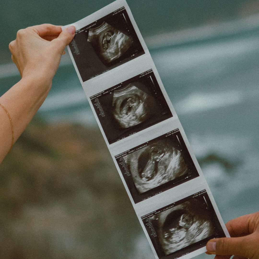 Photo shared by Miranda for their Babylist baby registry.