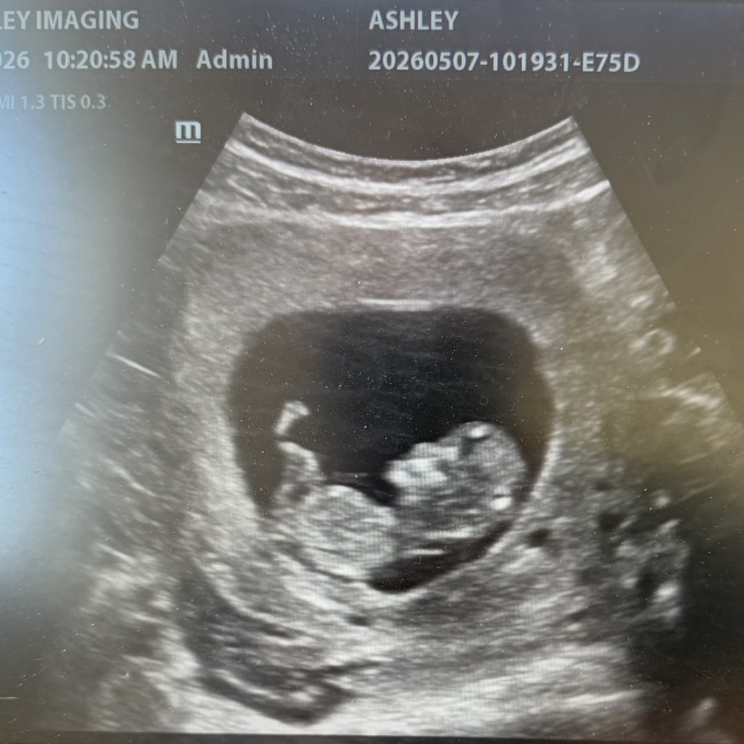 Photo shared by Ashley for their Babylist baby registry.