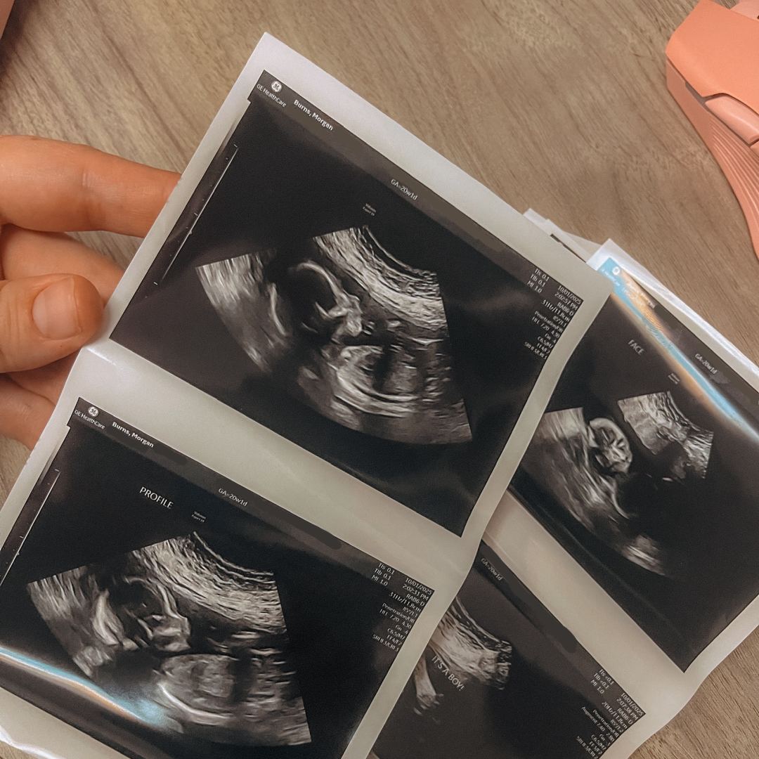 Photo shared by Morgan for their Babylist baby registry.