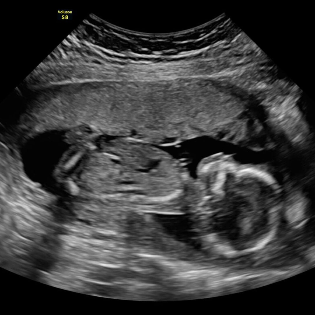 Photo shared by Chelsie for their Babylist baby registry.
