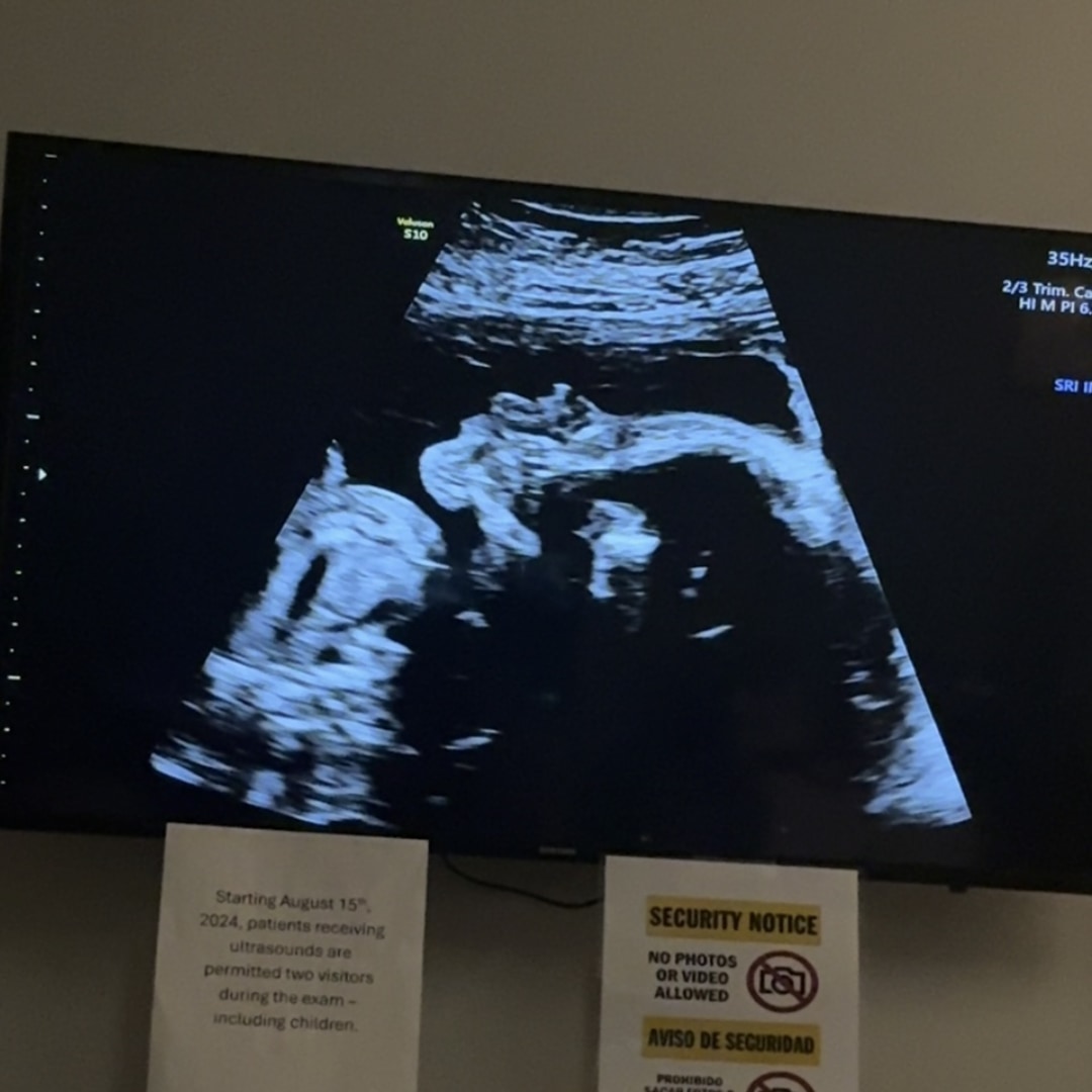 Photo shared by Emily for their Babylist baby registry.