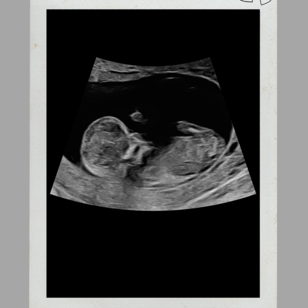Photo shared by Isabella for their Babylist baby registry.
