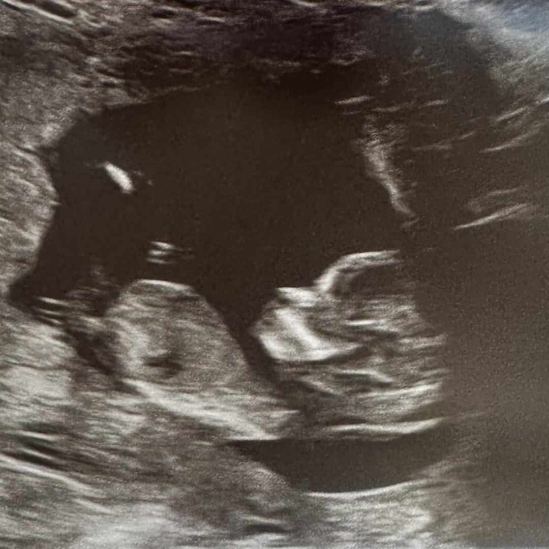 Photo shared by Jillian for their Babylist baby registry.