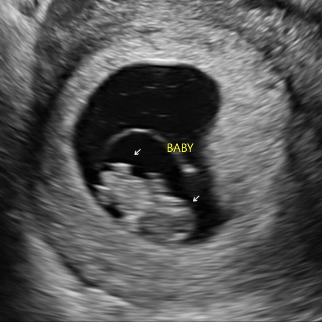 Photo shared by Anna for their Babylist baby registry.