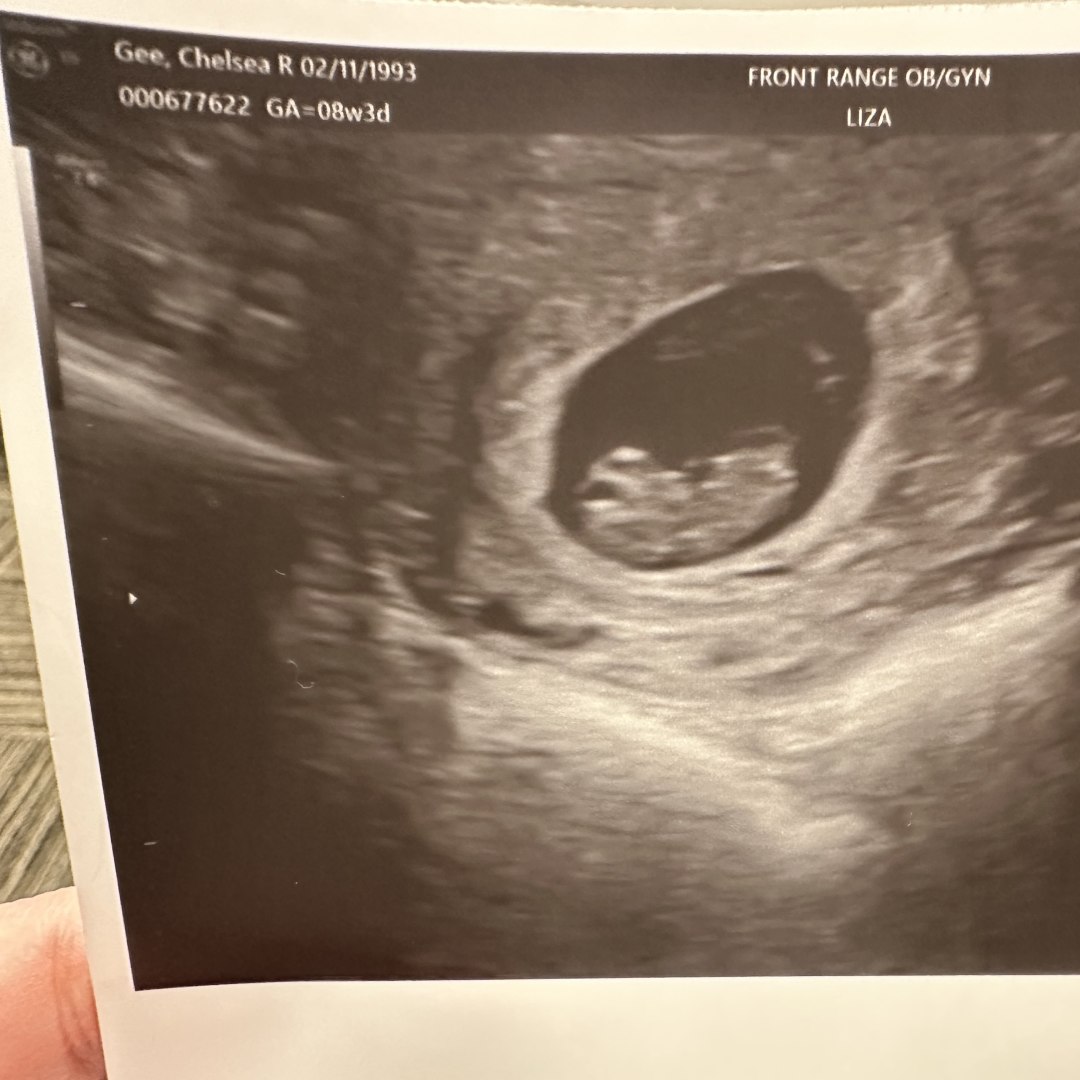 Photo shared by Chelsea for their Babylist baby registry.