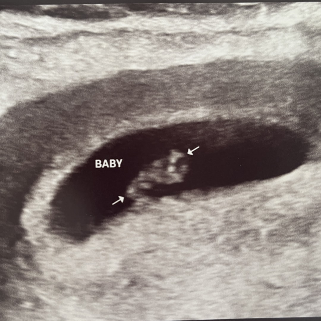 Photo shared by Kaity for their Babylist baby registry.