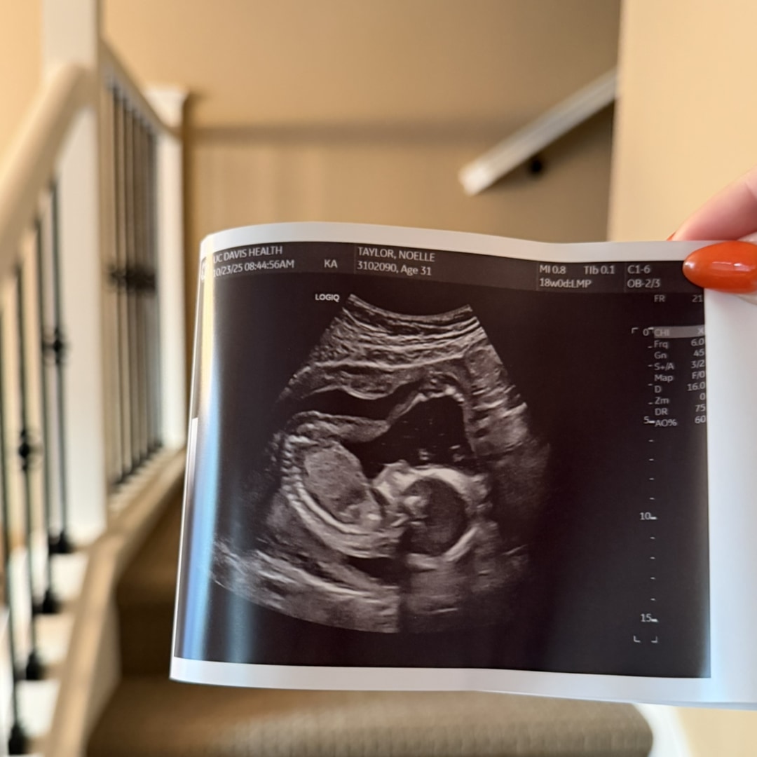 Photo shared by Noelle for their Babylist baby registry.