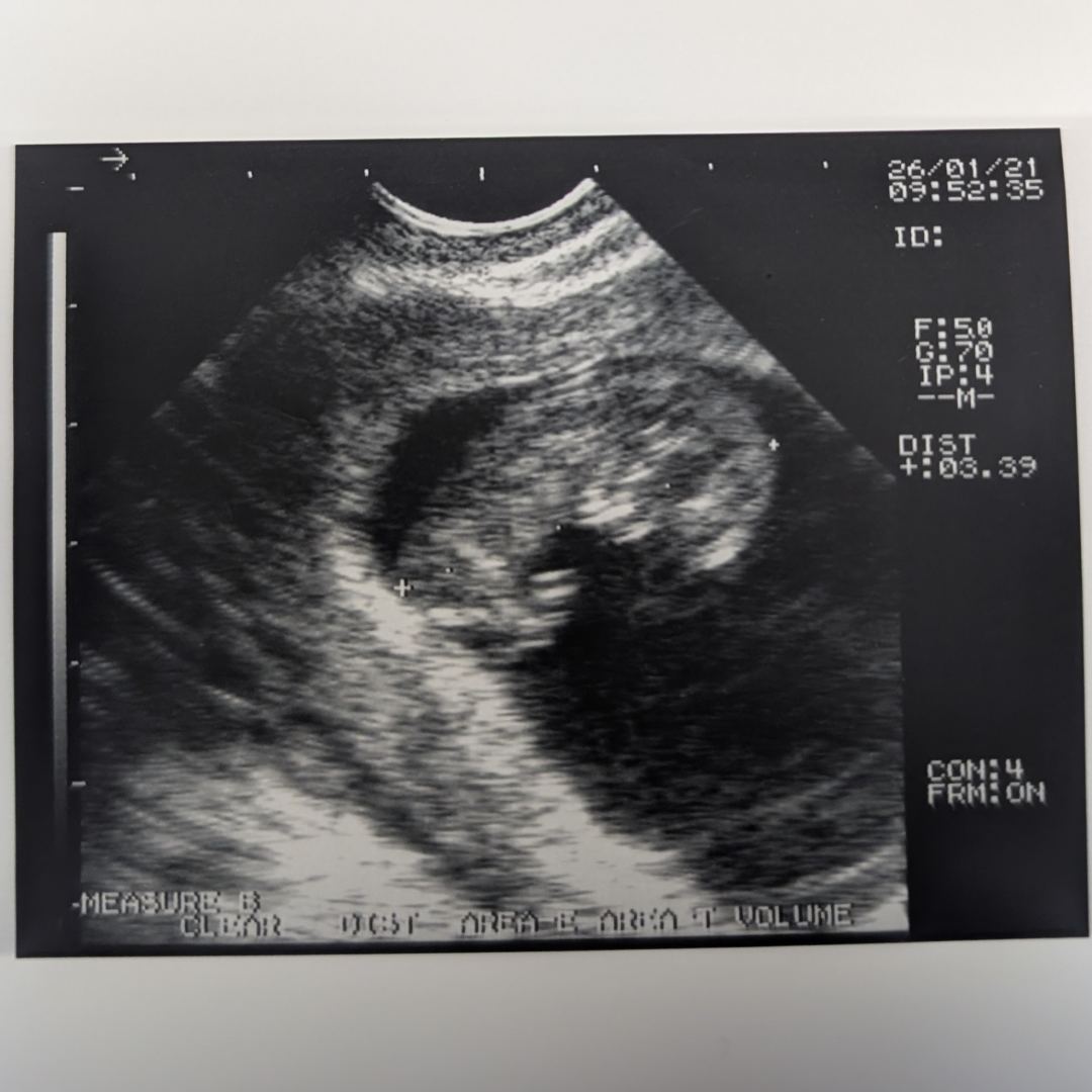 Photo shared by Taylor for their Babylist baby registry.