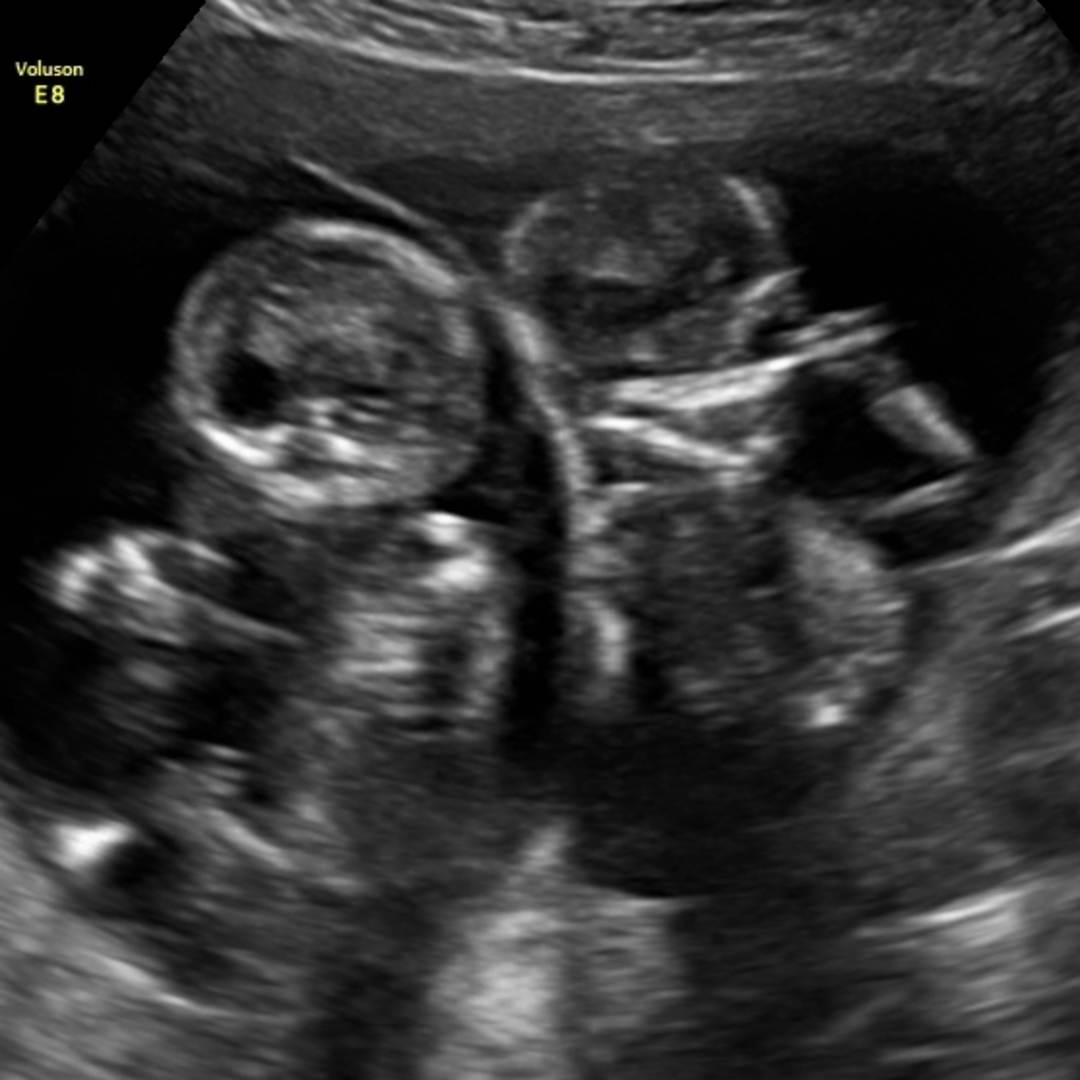Photo shared by Danielle for their Babylist baby registry.