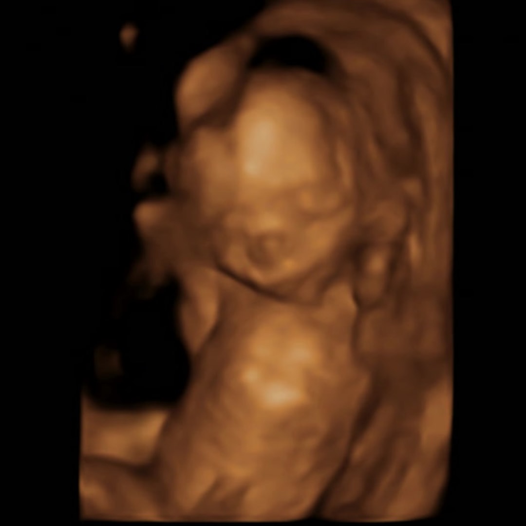 Photo shared by Melissa for their Babylist baby registry.