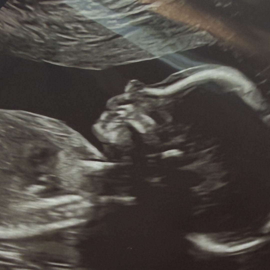 Photo shared by Brianna for their Babylist baby registry.