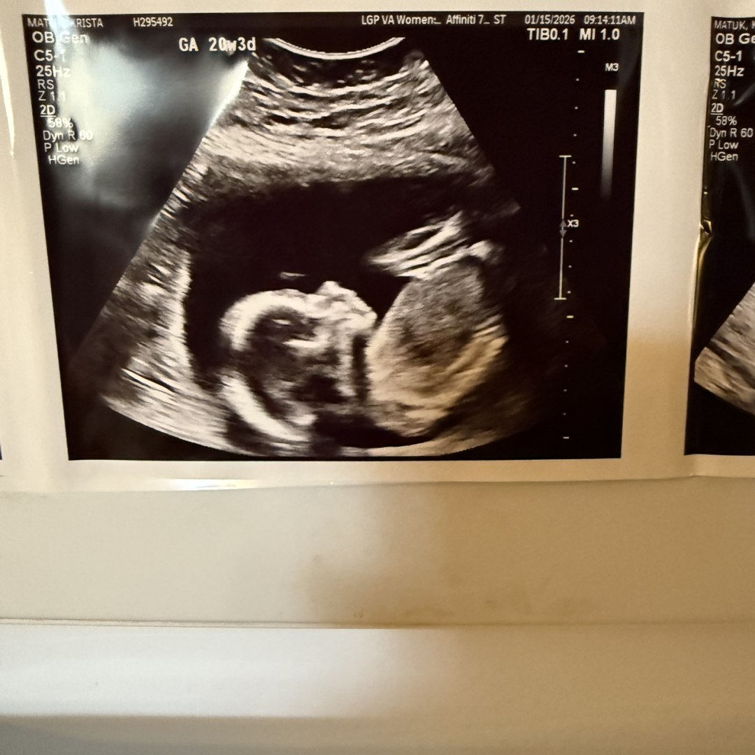 Photo shared by Krista for their Babylist baby registry.