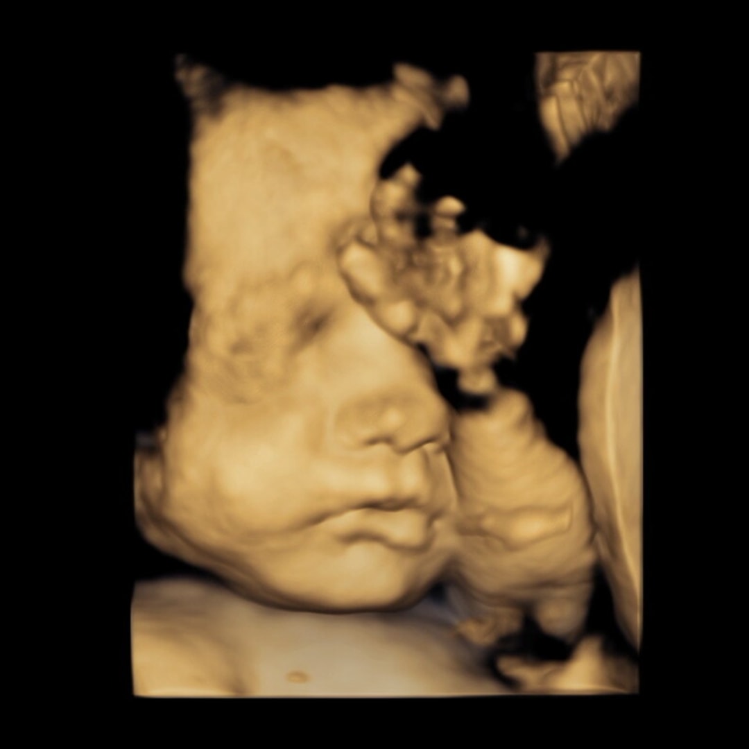 Photo shared by Tim for their Babylist baby registry.