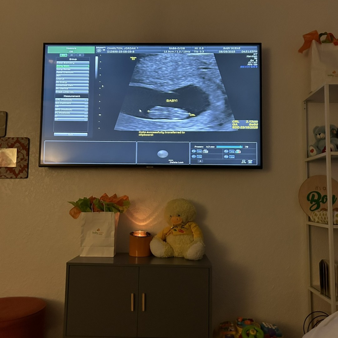 Photo shared by Jordan for their Babylist baby registry.