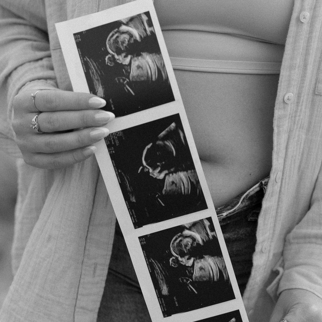 Photo shared by Dakota for their Babylist baby registry.
