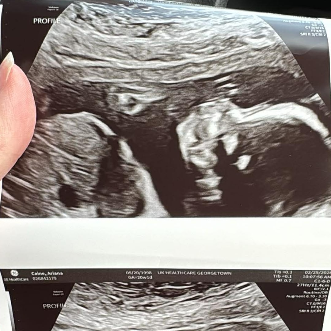 Photo shared by Ariana for their Babylist baby registry.