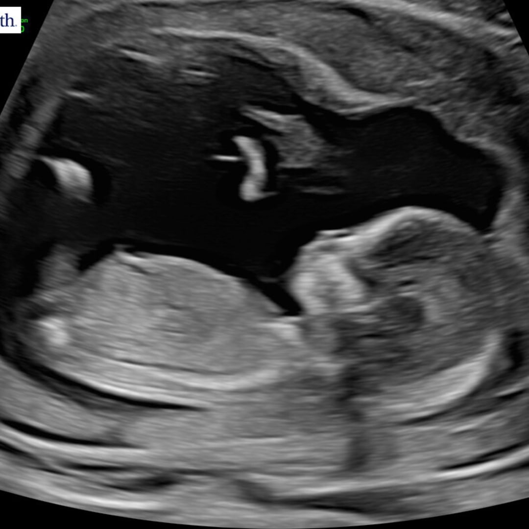 Photo shared by Sadie for their Babylist baby registry.