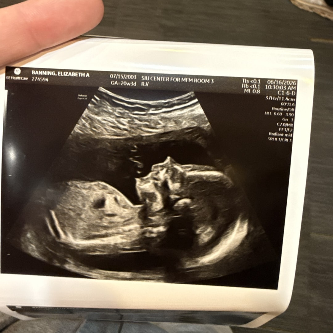 Photo shared by Elizabeth for their Babylist baby registry.