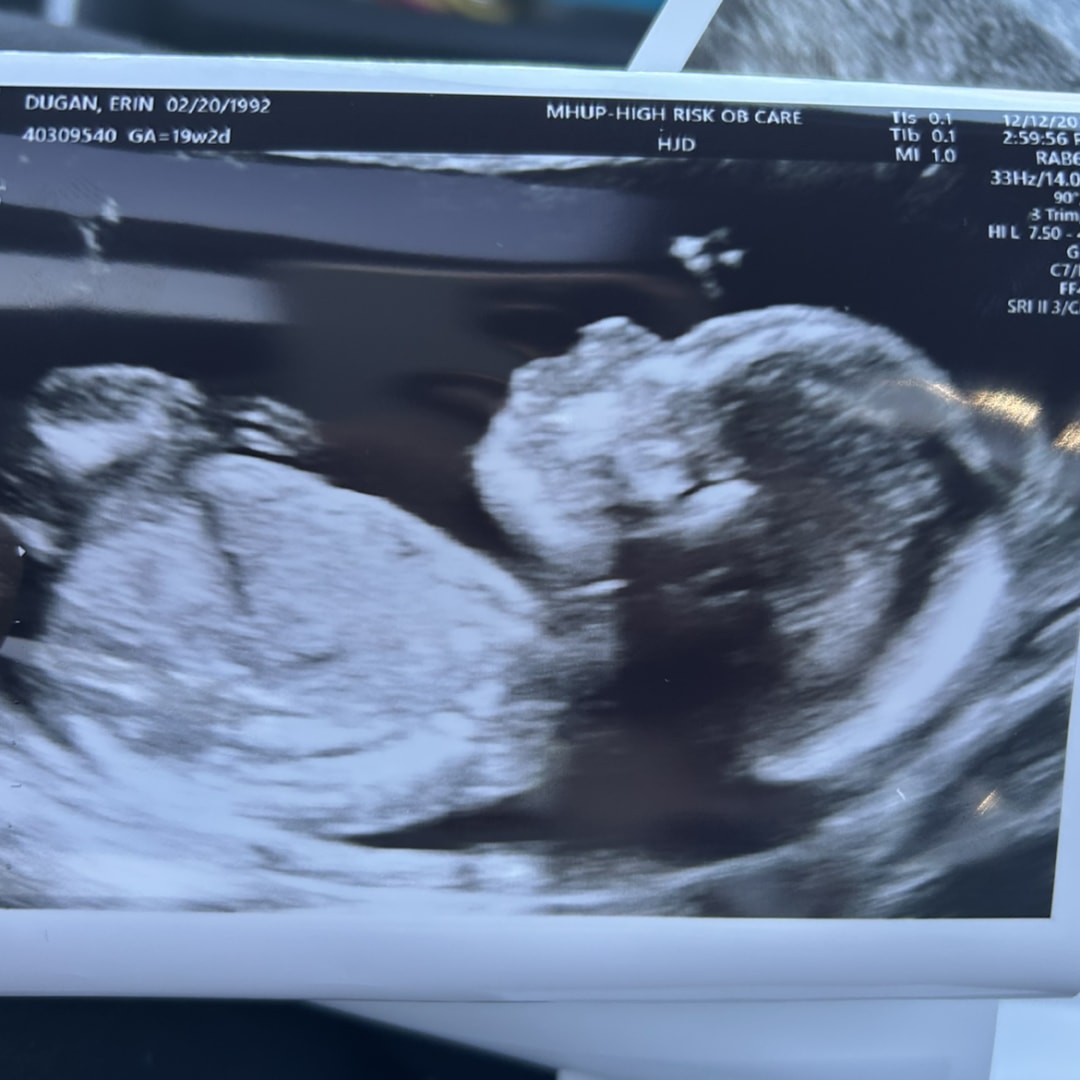 Photo shared by Erin for their Babylist baby registry.