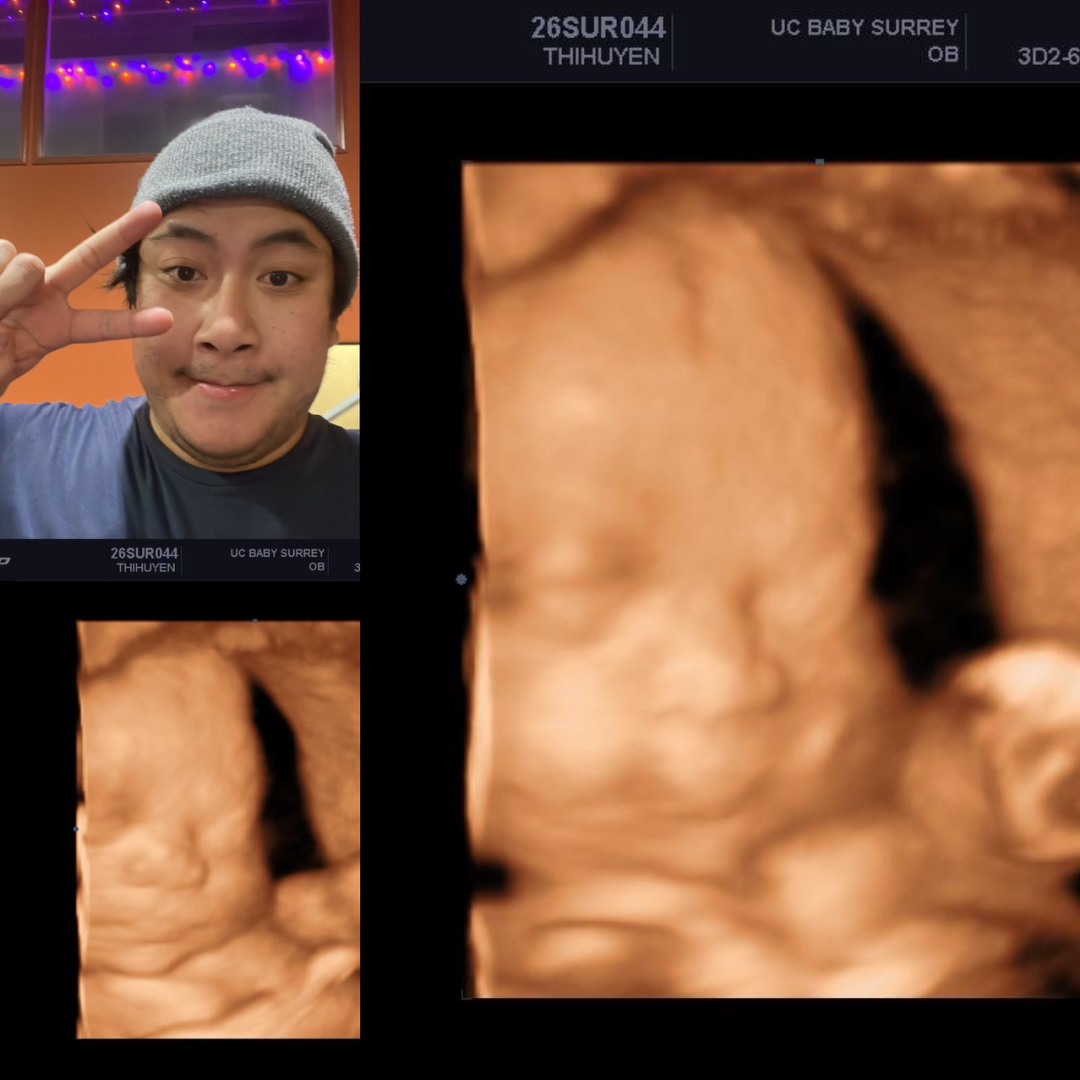 Photo shared by Caleb for their Babylist baby registry.