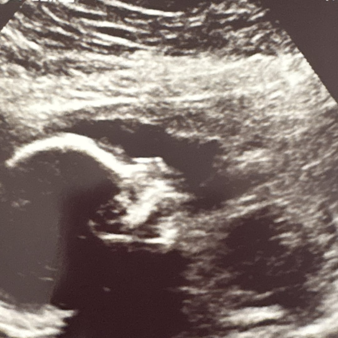Photo shared by Yessenia for their Babylist baby registry.