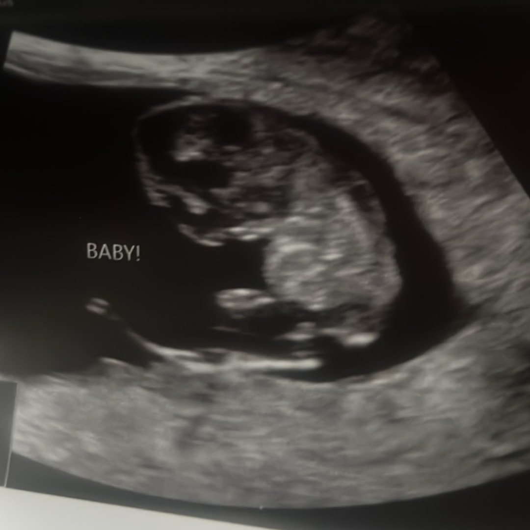 Photo shared by Madison for their Babylist baby registry.