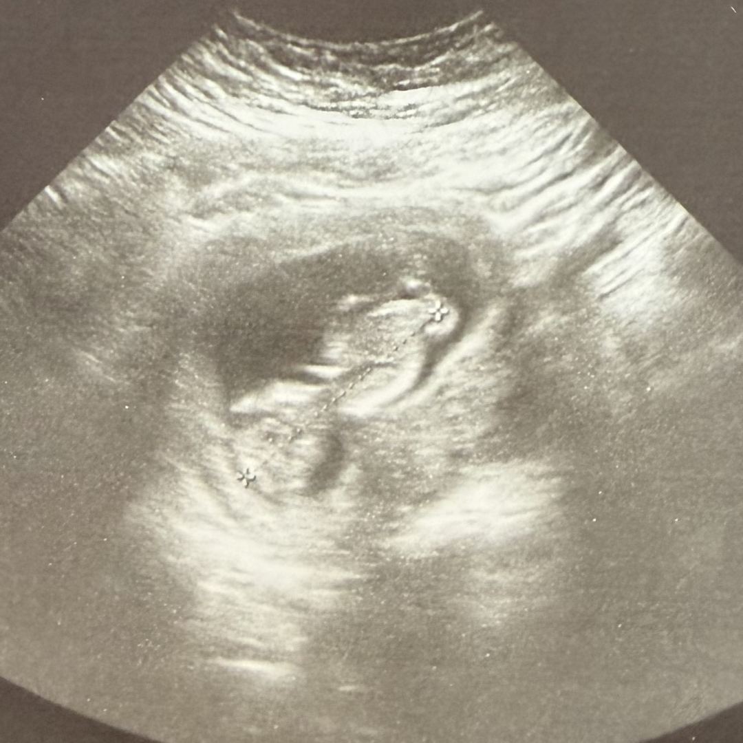 Photo shared by Rosa for their Babylist baby registry.