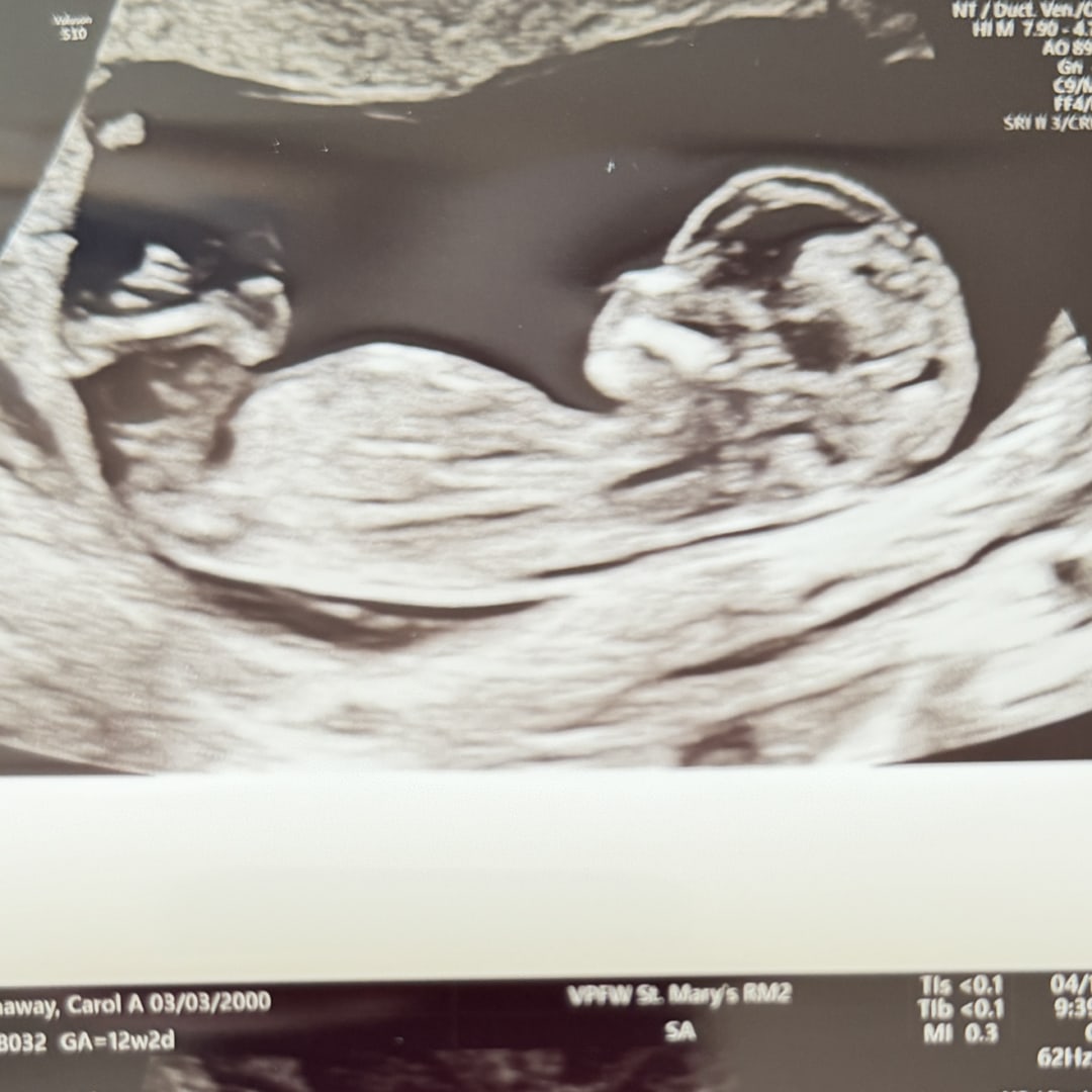 Photo shared by Carol for their Babylist baby registry.