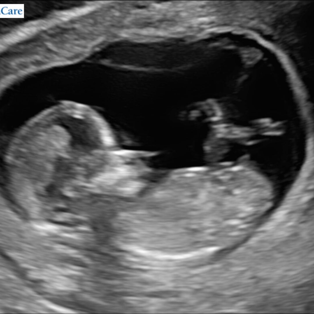 Photo shared by Mary for their Babylist baby registry.