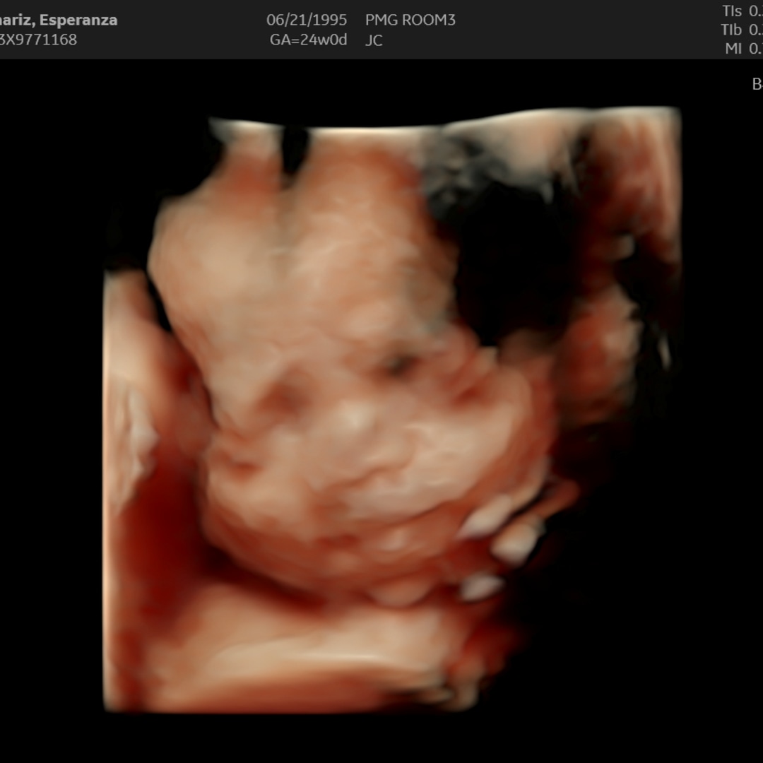 Photo shared by Esperanza for their Babylist baby registry.