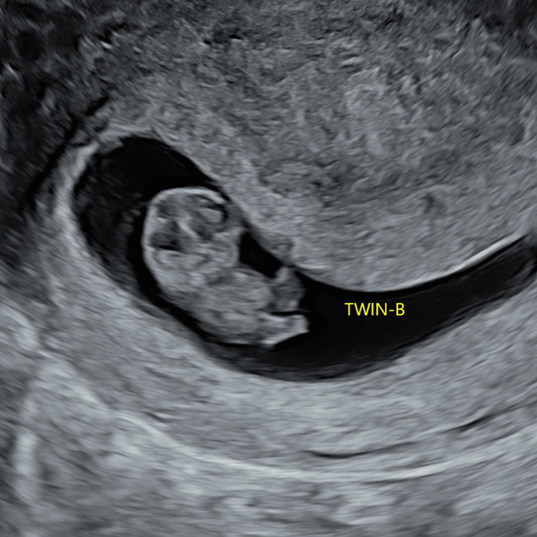 Photo shared by Holly for their Babylist baby registry.