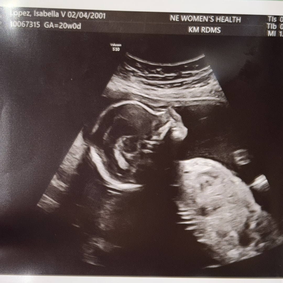Photo shared by Isabella for their Babylist baby registry.
