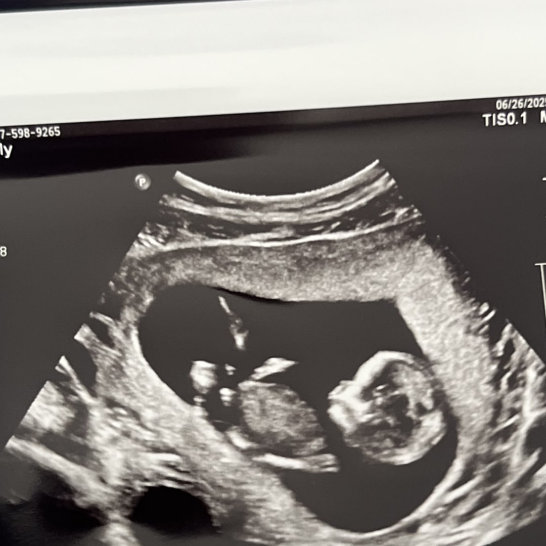 Photo shared by Talia for their Babylist baby registry.