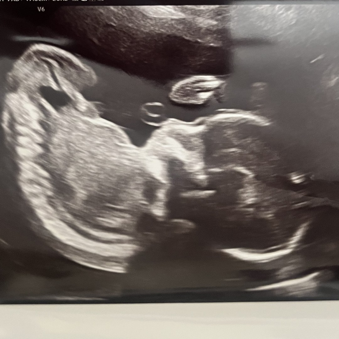 Photo shared by Rochelle for their Babylist baby registry.