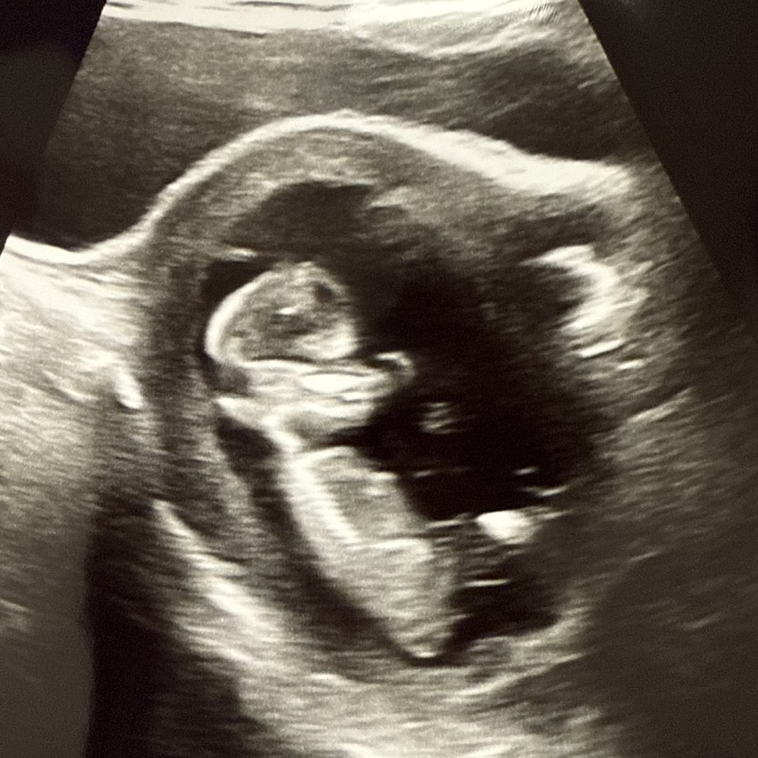 Photo shared by Cecilia for their Babylist baby registry.