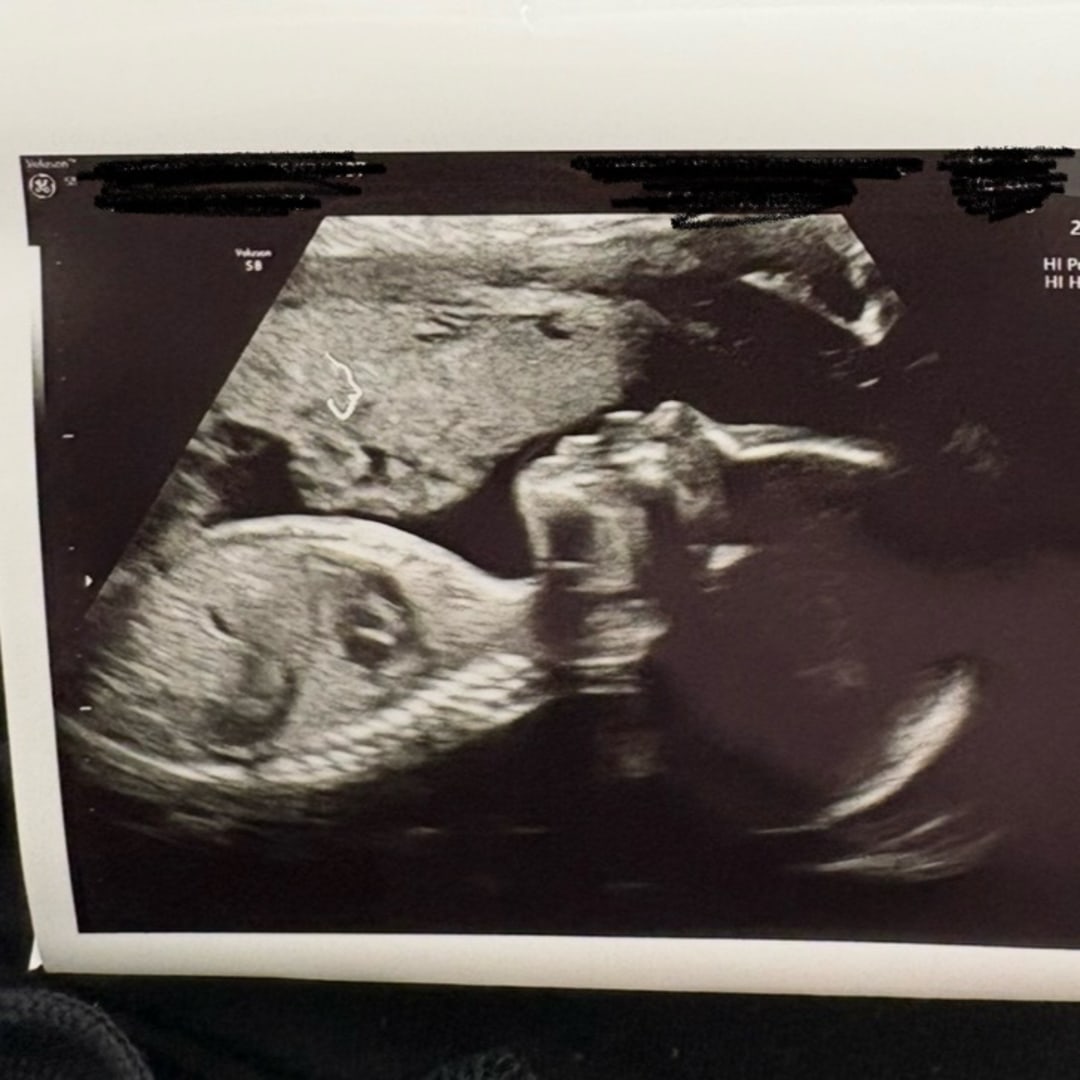 Photo shared by Emily for their Babylist baby registry.