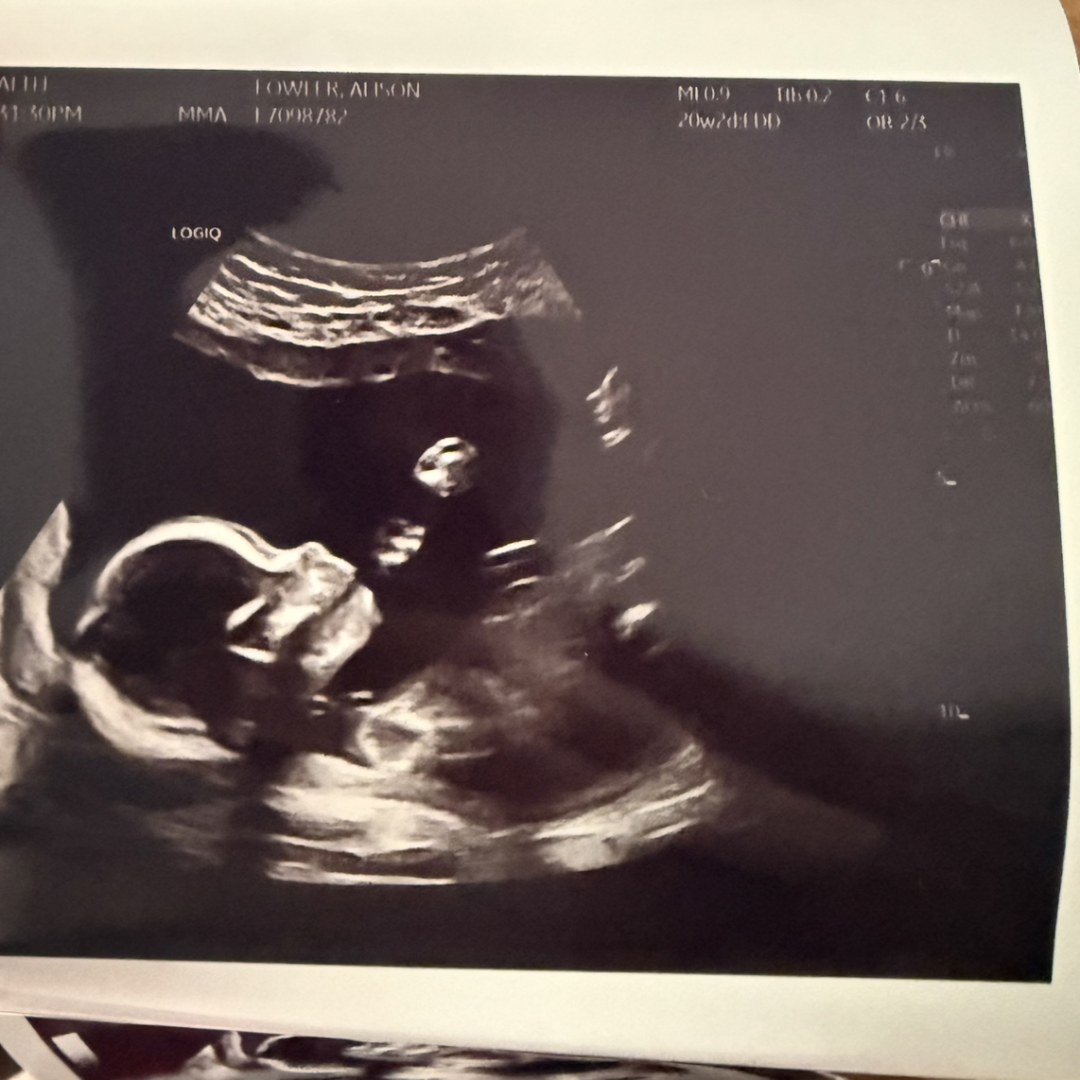 Photo shared by Alison for their Babylist baby registry.
