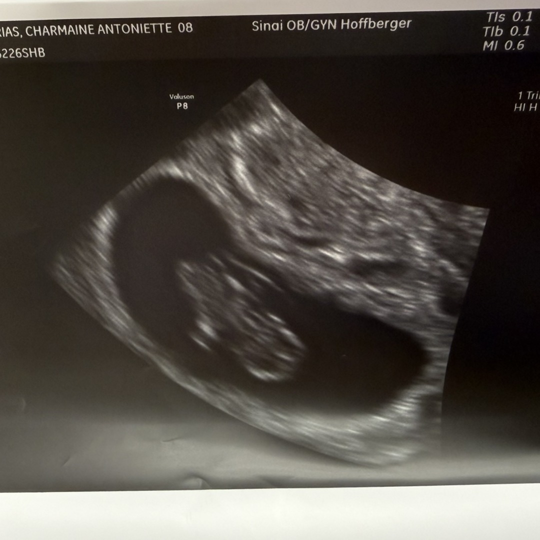 Photo shared by Charmaine for their Babylist baby registry.