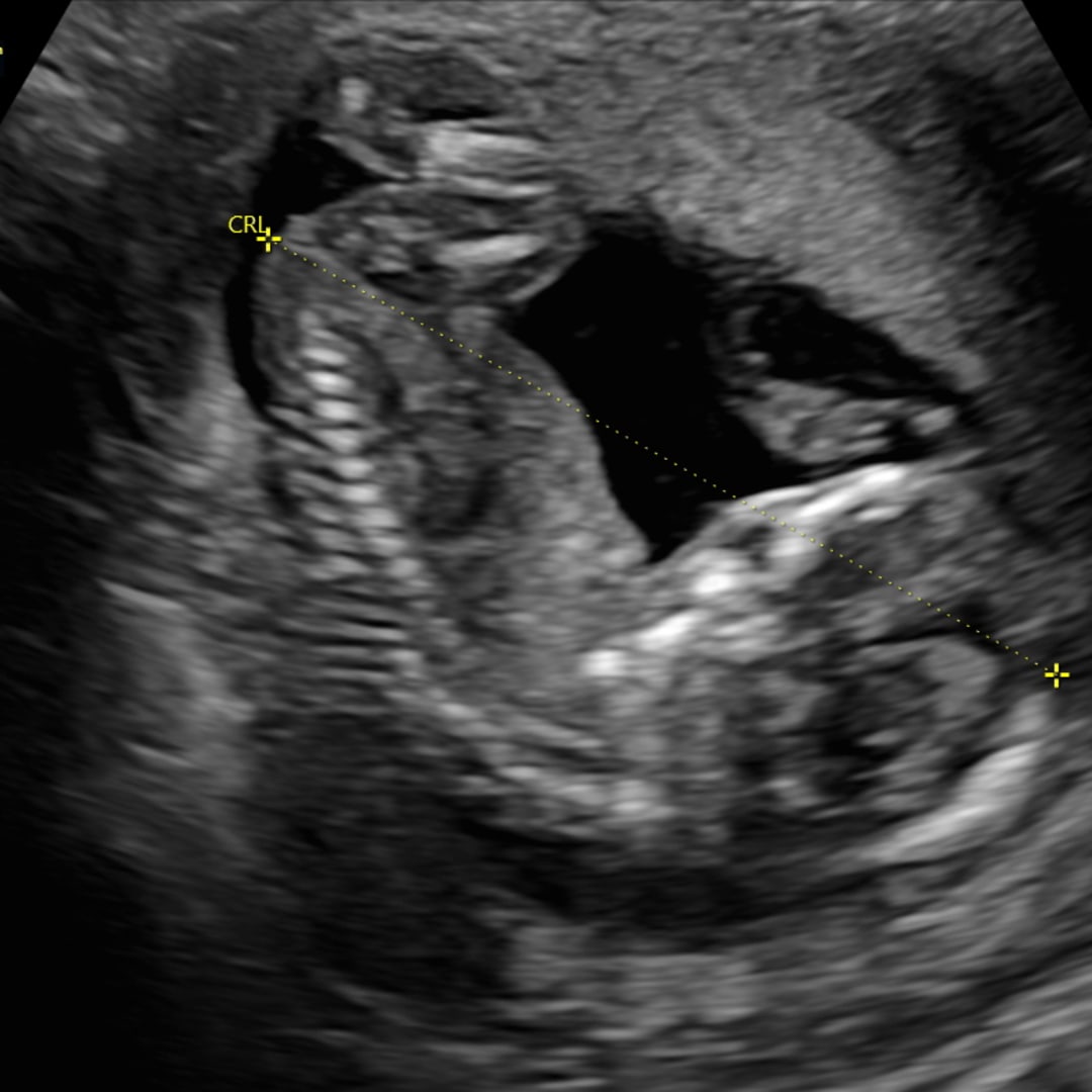 Photo shared by Emily for their Babylist baby registry.